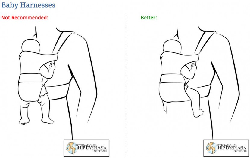 the diagram above shows illustrates how keeping baby&#039;s hips flexed...