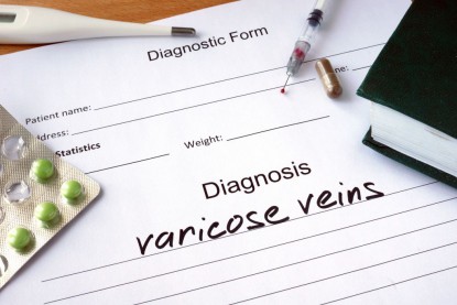Varicose Veins Concerns