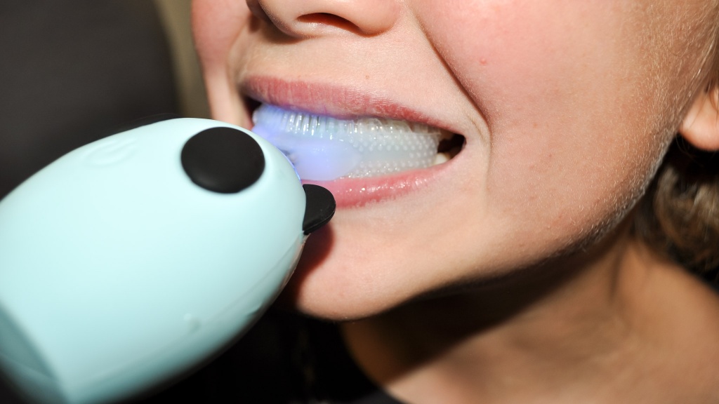 electric toothbrush kids - the u-style design isn&#039;t deep enough to reach the gum line leaving...