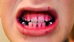 Dye before the use of the U-Type brush.