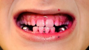 Dye after the use of the U-Type brush; you can see there is...