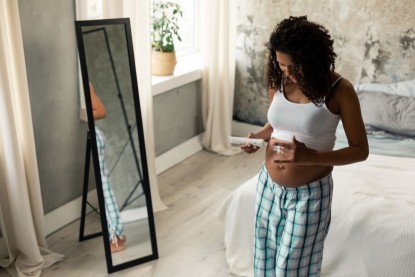 Can You Prevent Stretch Marks?