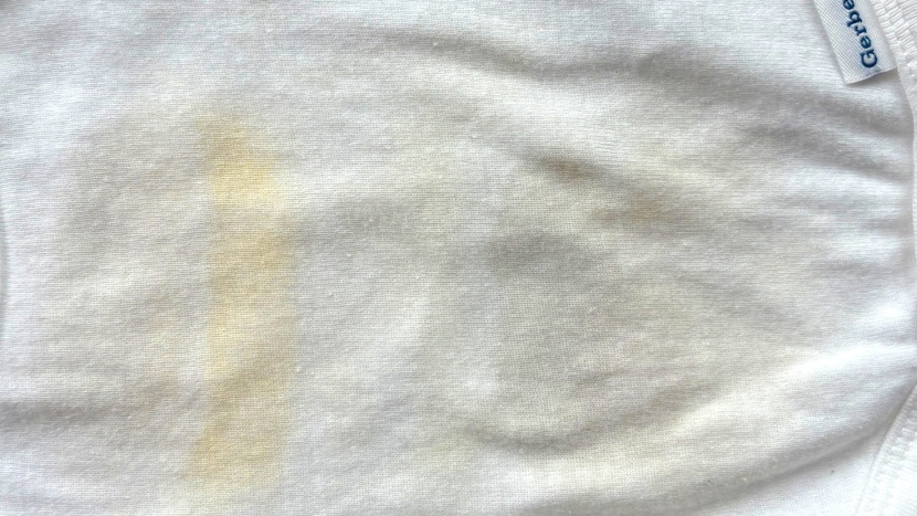 After photo comparison