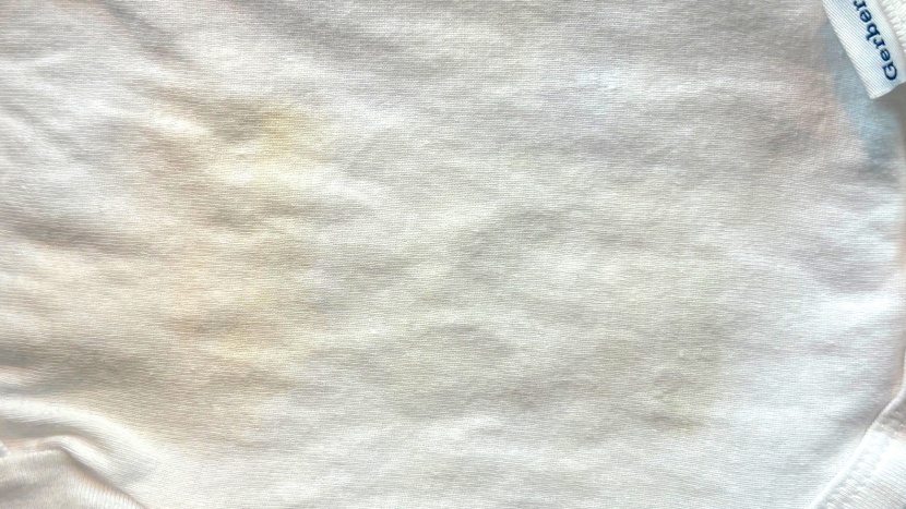 After photo comparison